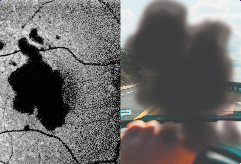 What may happen to your retina_4, What you may see_4